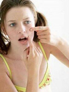 how to get rid of spots pimple